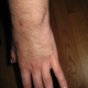 Image for article titled 10 Of The Grossest Stories You'll Ever Read